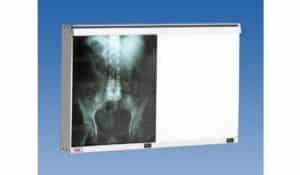 Wolf Double Panel X-Ray Illuminator | 29602