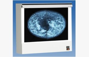 Wolf Double Unit VuPlus Mammography Viewer, Venture Medical Requip.