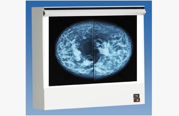 Wolf Double Unit VuPlus Mammography Viewer