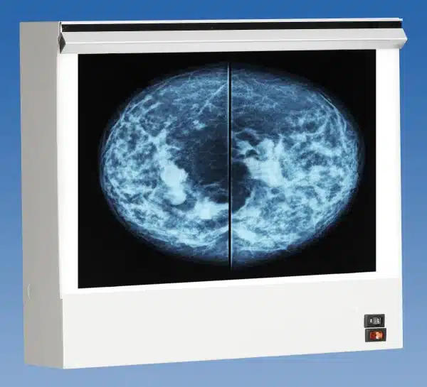 Wolf Double Unit VuPlus Mammography Viewer, Venture Medical Requip.