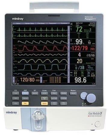 Patient Monitoring, DIONA Patient Monitor